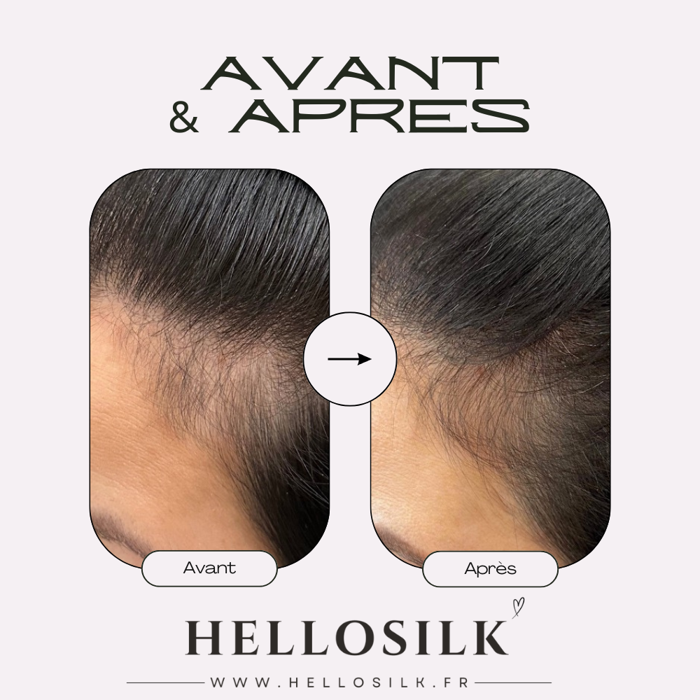 Taie d'oreiller en soie Santé des cheveux et de la peau.