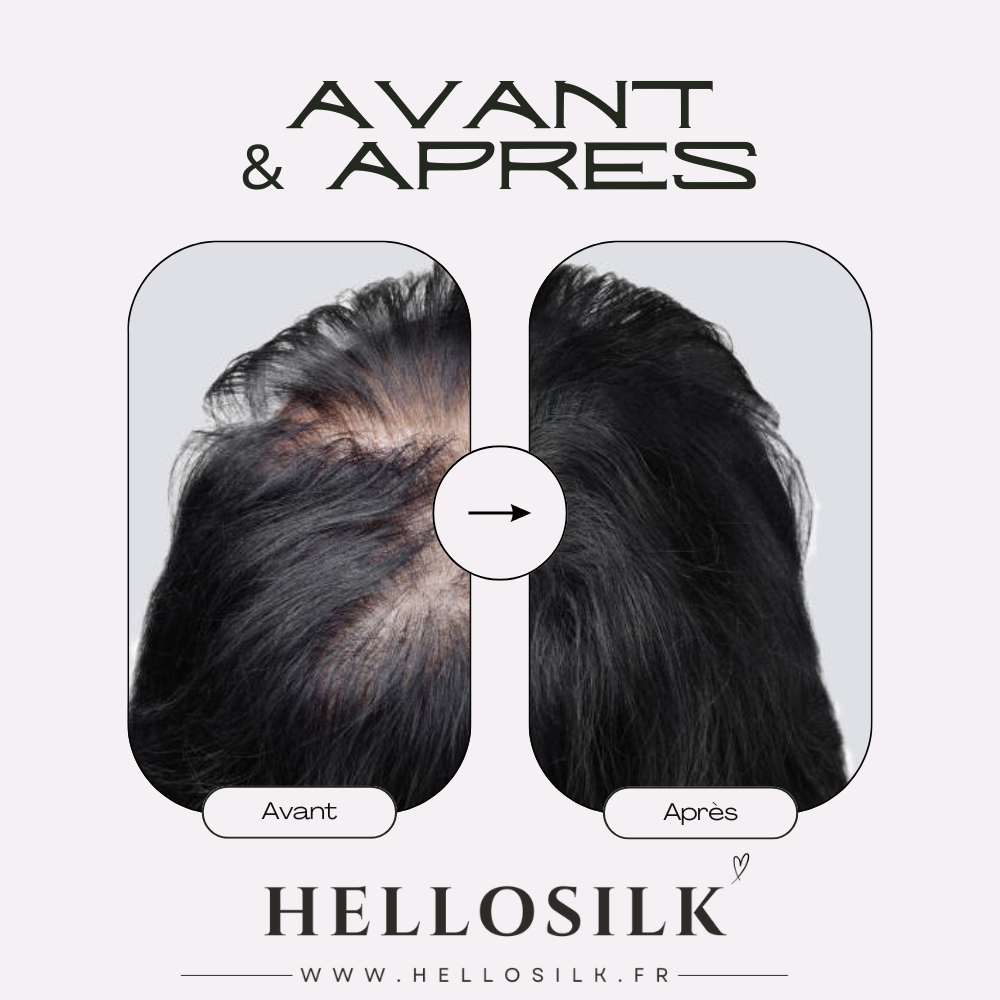 Taie d'oreiller en soie Santé des cheveux et de la peau.